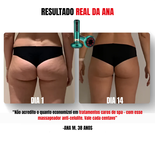 Cellur Max - Massageador [Anti-Celulite]