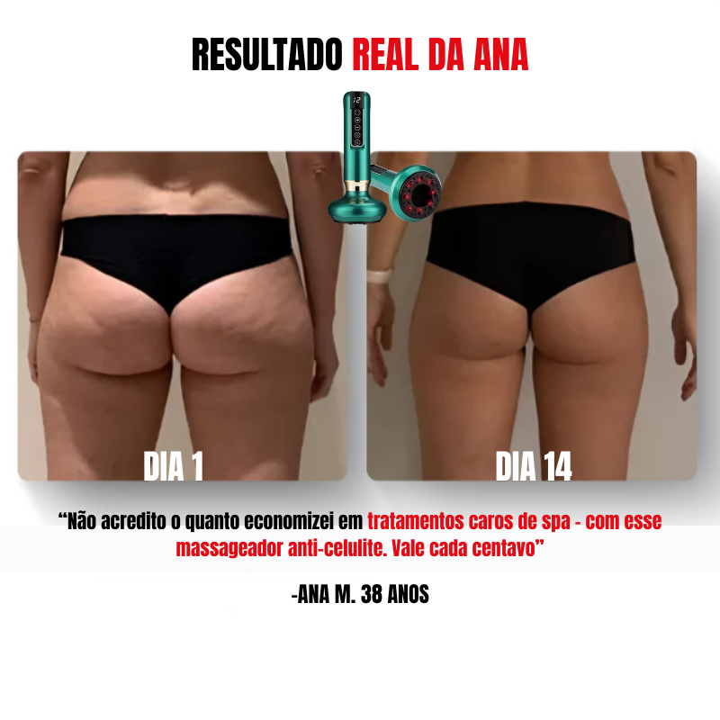 Cellur Max - Massageador [Anti-Celulite]